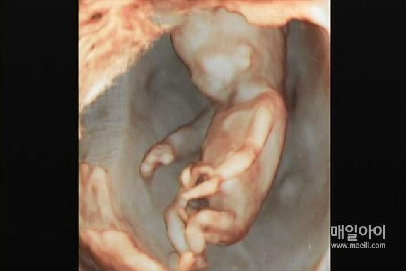 [매일아이] 임신 4개월 태아와 모체의 변화